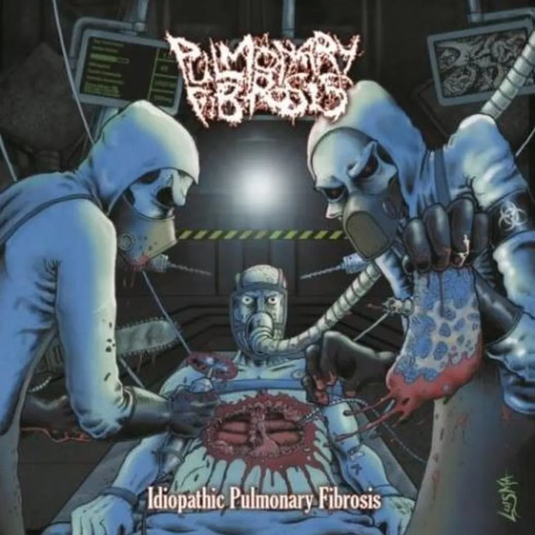 Idiopathic Pulmonary Fibrosis