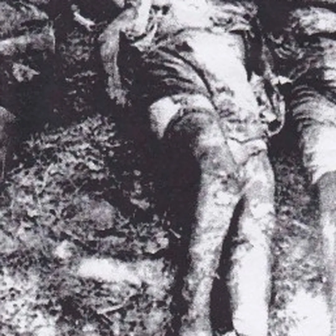 Pulmonary Fibrosis / Cakewet / Vomitrocity / Flesh Disgorged / Copremesis