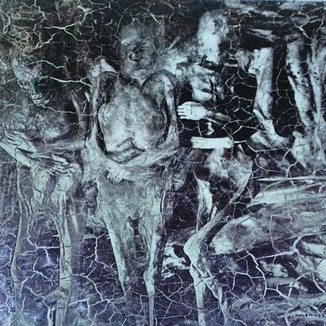 Tooth, Teeth, Milk, Teeth, Skin