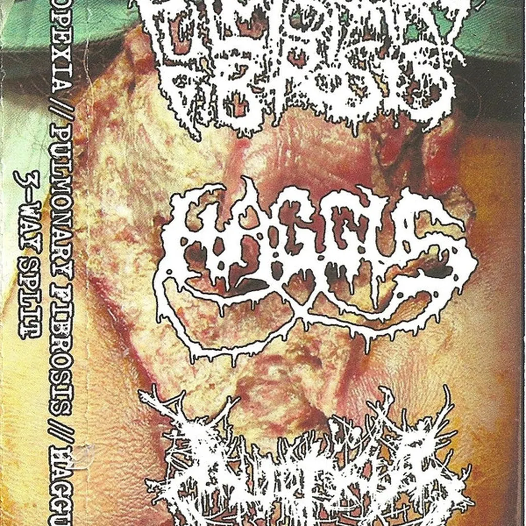 Haggus / Inopexia / Pulmonary Fibrosis